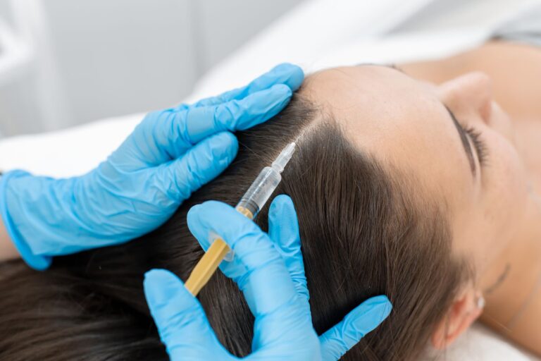 Best PRP Hair Treatment in Toronto: A Complete Guide to Hair Restoration