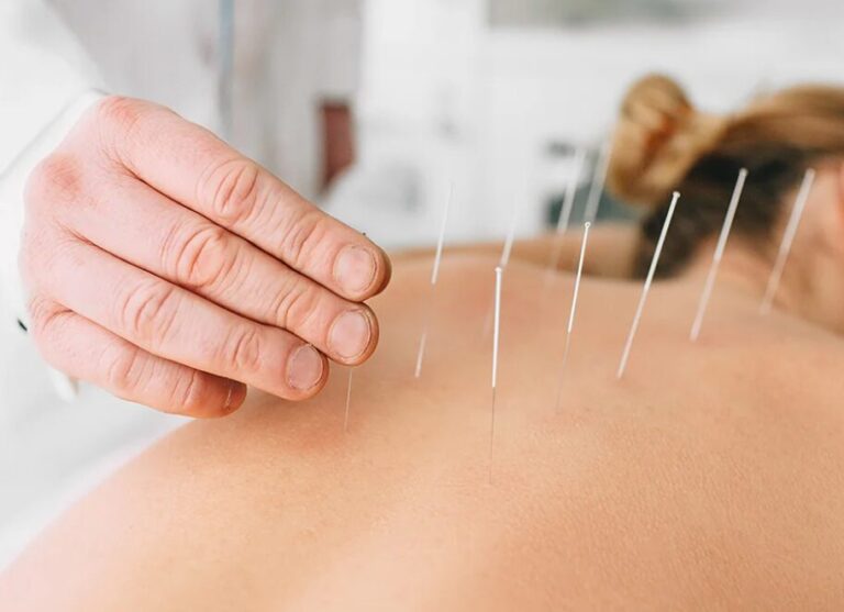 Why Chronic Pain Patients Eventually End Up Trying Acupuncture
